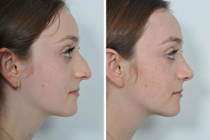 Image for Plastic Surgery SEO with ID of: 2449232