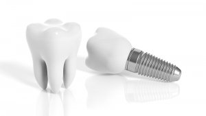 Image for McBride Dental with ID of: 2473140