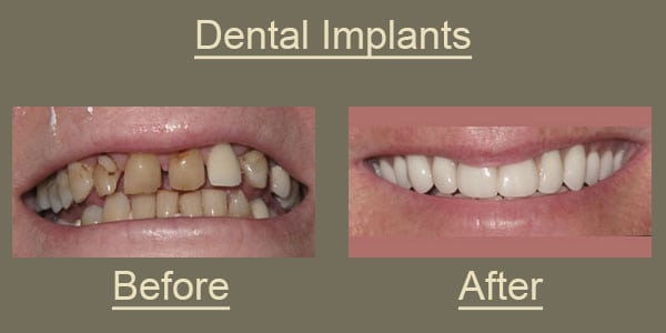 Image for McBride Dental with ID of: 2473145