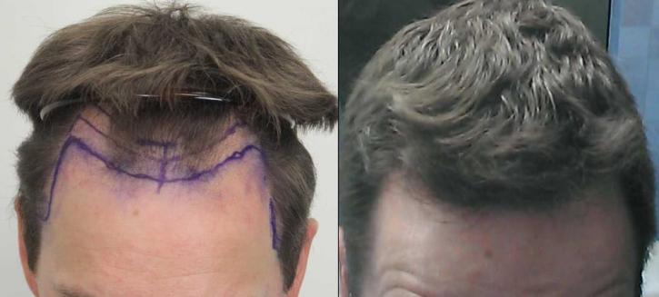 Image for Rahal Hair Transplant Toronto with ID of: 2501356