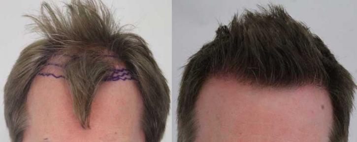 Image for Rahal Hair Transplant Toronto with ID of: 2501367