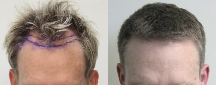 Image for Rahal Hair Transplant Toronto with ID of: 2501373