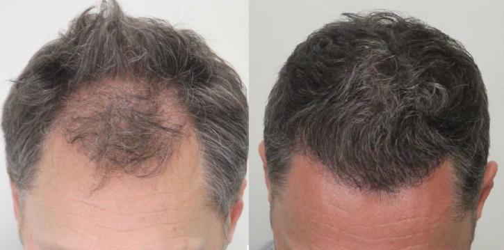 Image for Rahal Hair Transplant Toronto with ID of: 2501376