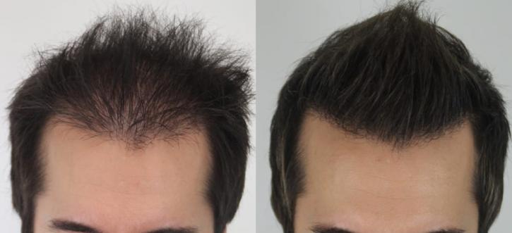 Image for Rahal Hair Transplant Toronto with ID of: 2501379