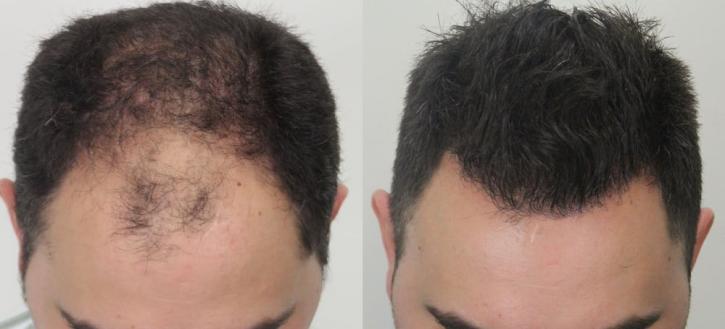 Image for Rahal Hair Transplant Toronto with ID of: 2501381