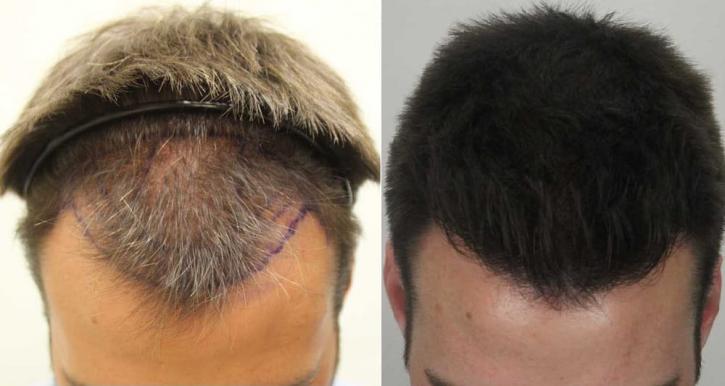 Image for Rahal Hair Transplant Toronto with ID of: 2501389