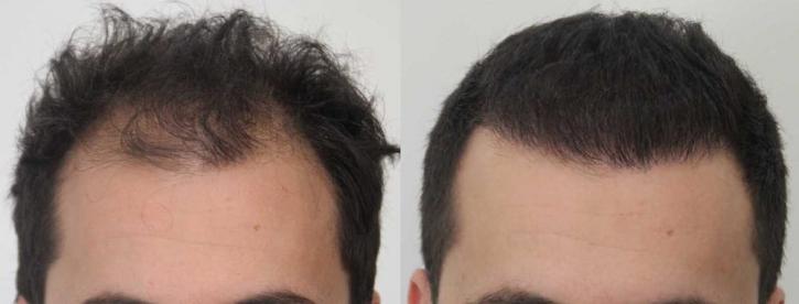 Image for Rahal Hair Transplant Toronto with ID of: 2501391