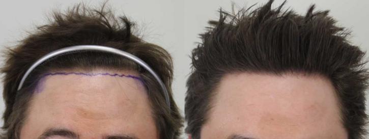 Image for Rahal Hair Transplant Toronto with ID of: 2501392