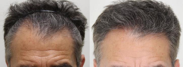 Image for Rahal Hair Transplant Toronto with ID of: 2501398