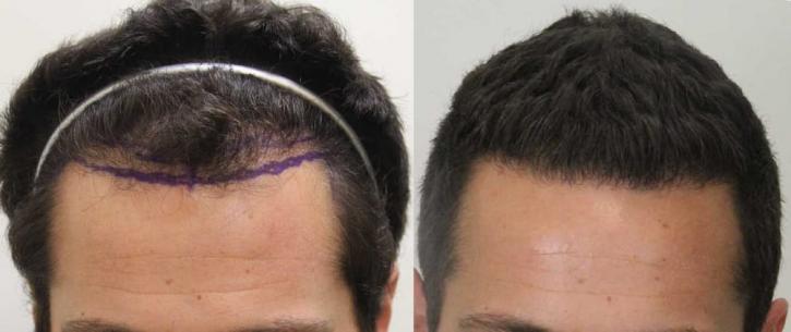 Image for Rahal Hair Transplant Toronto with ID of: 2501400