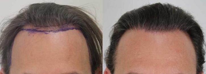 Image for Rahal Hair Transplant Toronto with ID of: 2501401