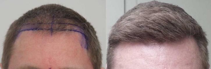 Image for Rahal Hair Transplant Toronto with ID of: 2501407