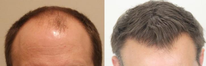 Image for Rahal Hair Transplant Toronto with ID of: 2501409