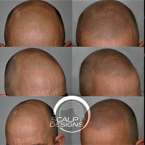 Image for Scalp Designs with ID of: 2550112