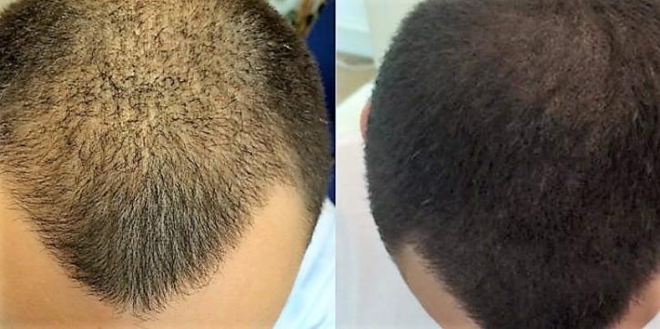 Image for Scalp Designs with ID of: 2550115