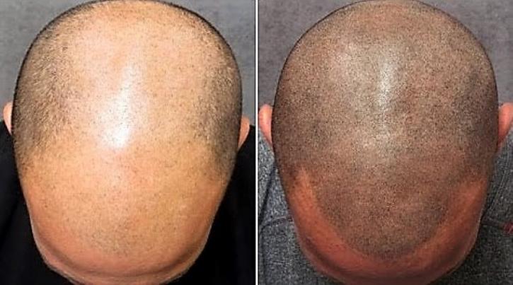 Image for Scalp Designs with ID of: 2550117