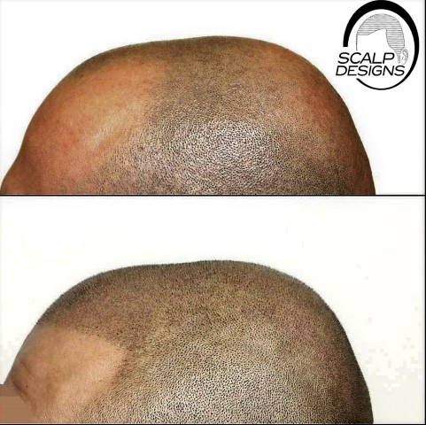 Image for Scalp Designs with ID of: 2550119