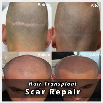 Image for HPC Scalp MicroPigmentation Center with ID of: 2577655