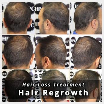Image for HPC Scalp MicroPigmentation Center with ID of: 2577662