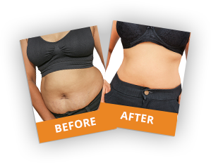 Image for Weight Loss and Nutrition Services with ID of: 2594707