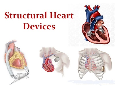 Image for Structural Heart Devices Market Opportunity Analysis, 2018-2026 with ID of: 2597801