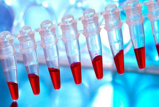 Image for Cell Line Development Market Set for Rapid Growth | Trend and Analysis, 2018-2026 with ID of: 2612083