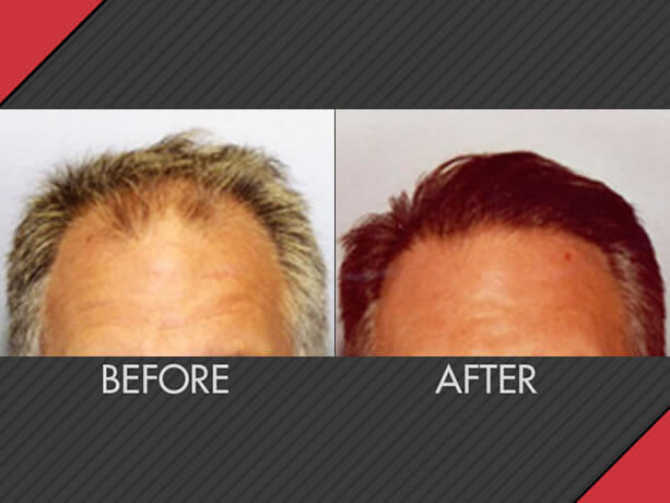 Image for MAXiM Hair Restoration with ID of: 2617137