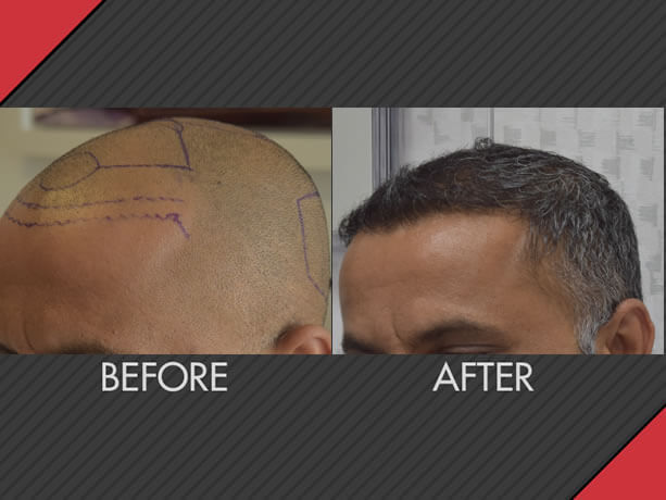 Image for MAXiM Hair Restoration with ID of: 2617140