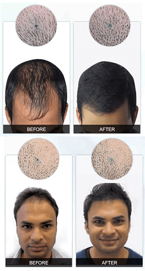 Image for Nutralyfe Regain : Reduce your Hair Fall with ID of: 2622110