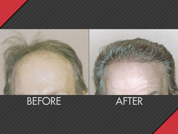 Image for MAXiM Hair Restoration with ID of: 2626493