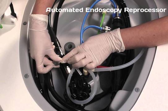 Image for Automated Endoscopy Reprocessor Market to Surpass US$ 2.5 Billion by 2026 with ID of: 2648482