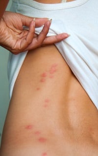 Image for Phoenix Bed Bug Expert with ID of: 2653850