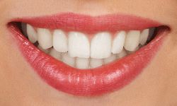 Image for Whitlock Orthodontics of Ft. Smith with ID of: 2683538