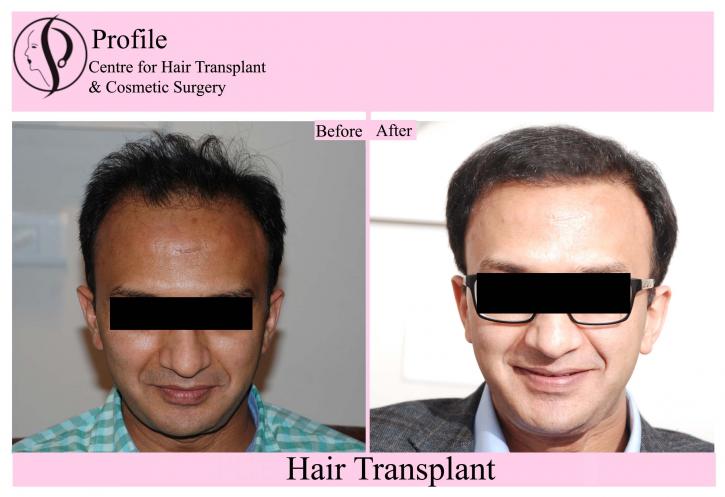 Image for Profile Hair Transplant Centre with ID of: 2694225