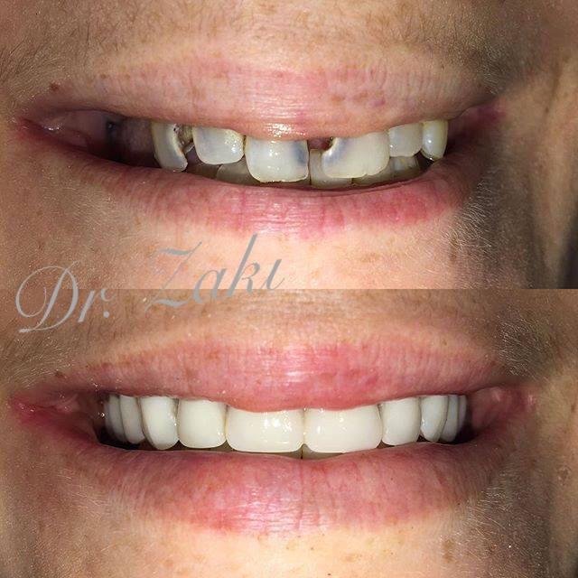 Image for Zaki Dental with ID of: 2735350
