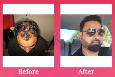 Image for Dr. Mohan’s Skin & Hair Centre with ID of: 2745967