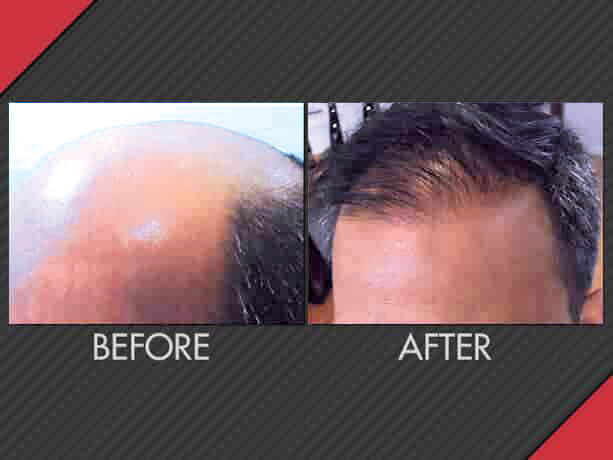 Image for MAXiM Hair Restoration with ID of: 2751946