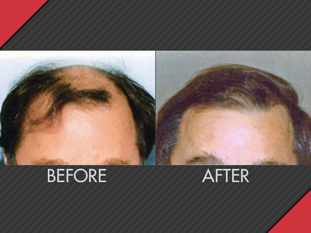 Image for MAXiM Hair Restoration with ID of: 2751948