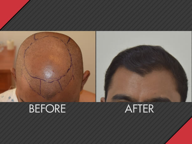 Image for MAXiM Hair Restoration with ID of: 2751949