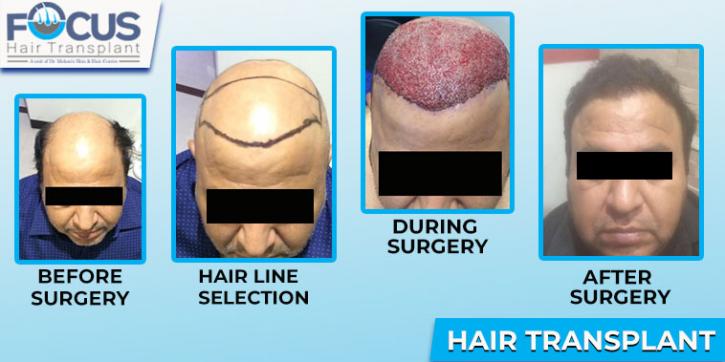 Image for Focus Hair Transplant Centre with ID of: 2754159