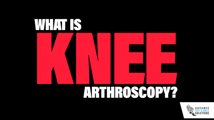 Image for What is Knee Arthroscopy? with ID of: 2779671