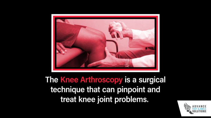 Image for What is Knee Arthroscopy? with ID of: 2779672