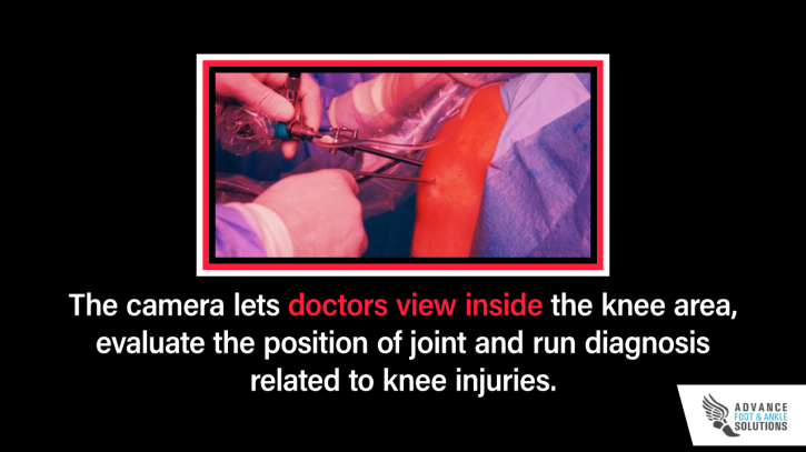 Image for What is Knee Arthroscopy? with ID of: 2779678