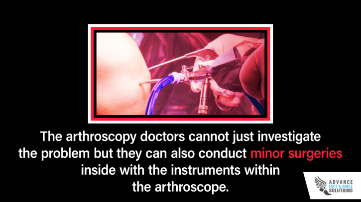 Image for What is Knee Arthroscopy? with ID of: 2779680