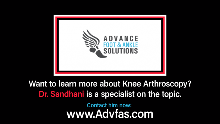 Image for What is Knee Arthroscopy? with ID of: 2779682