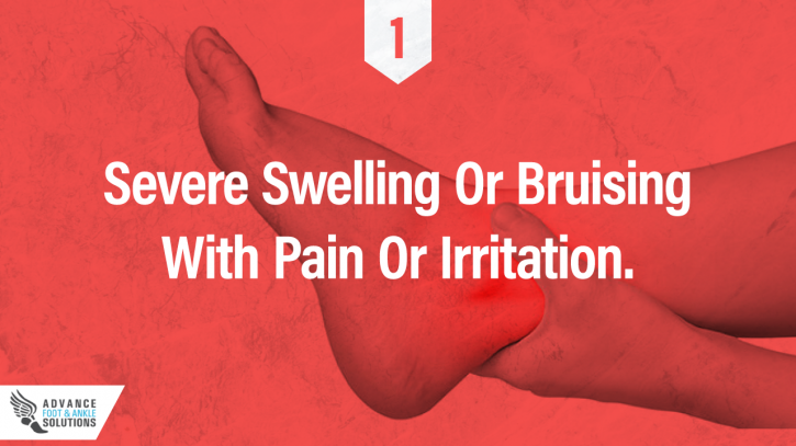 Image for How To Identify A Foot or Ankle Sprain with ID of: 2782734
