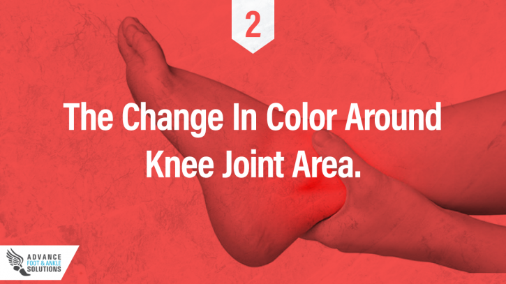 Image for How To Identify A Foot or Ankle Sprain with ID of: 2782740