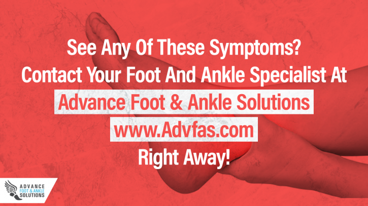 Image for How To Identify A Foot or Ankle Sprain with ID of: 2782741