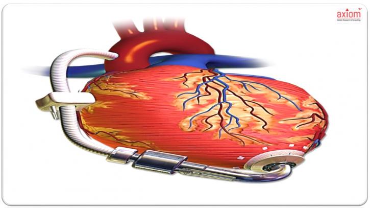 Image for Heart Pump Device Market Analysis, Trends, Share and Forecast Up To 2024 with ID of: 2790463