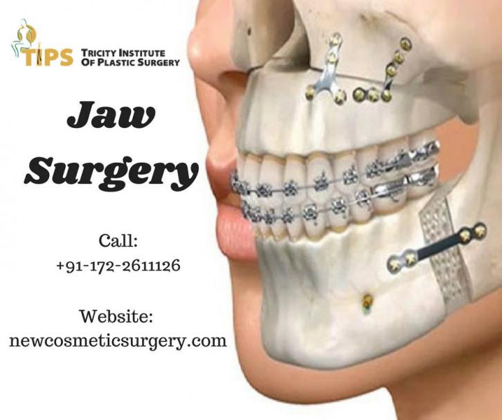 Image for Operate Jaw Augmentation Surgery With TIPS Institute with ID of: 2791590